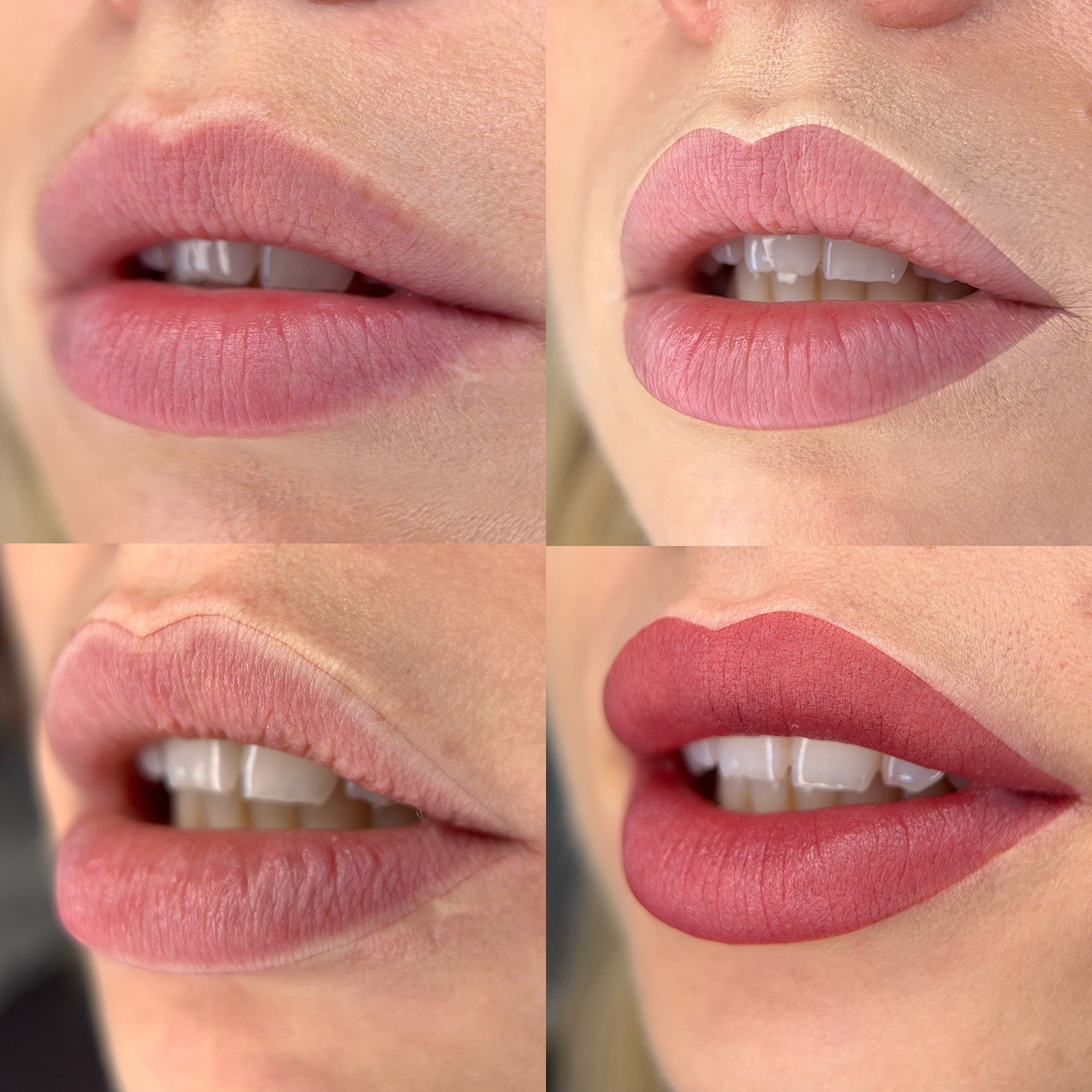 Comparison of fresh nude permanent makeup lips immediately after PMU treatment showing different healed goals and tissue response